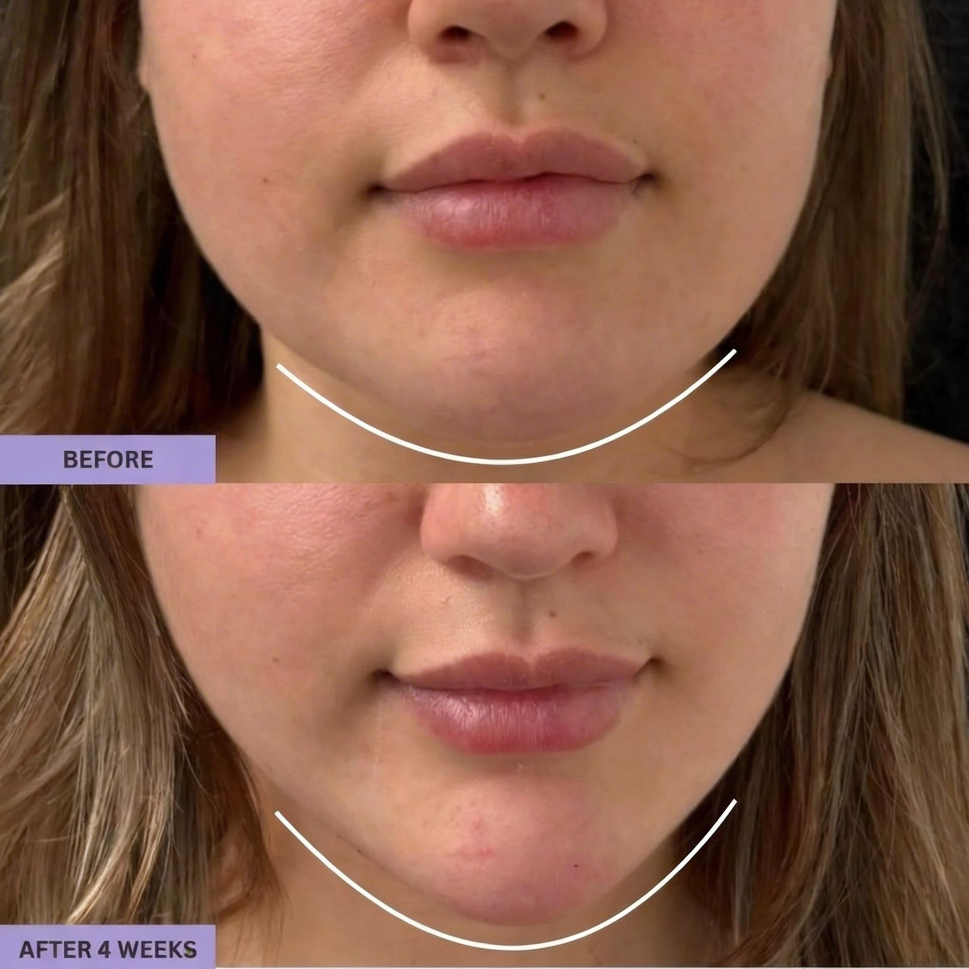 Gua Sha Brush for Snatched Face