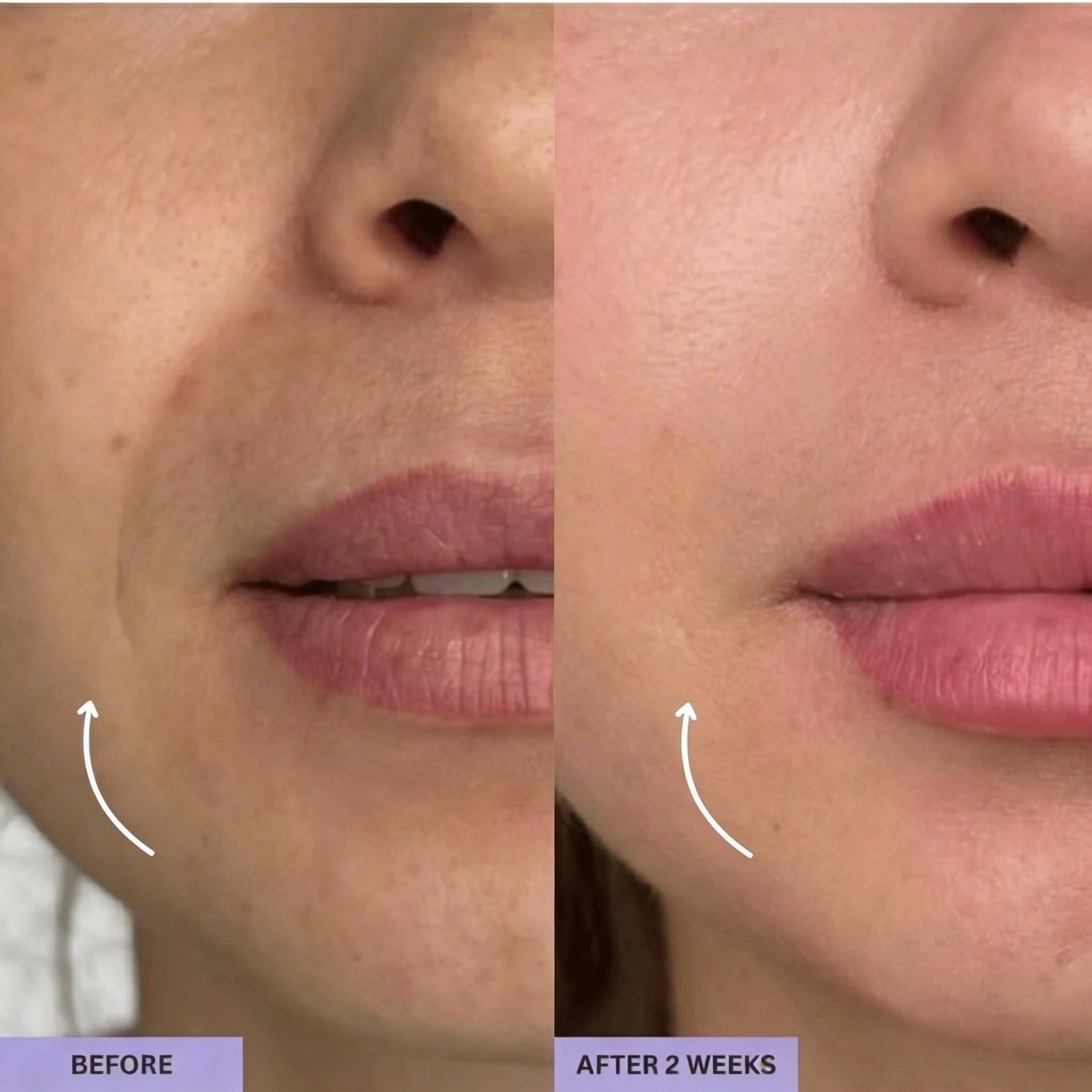 Gua Sha Brush for Snatched Face