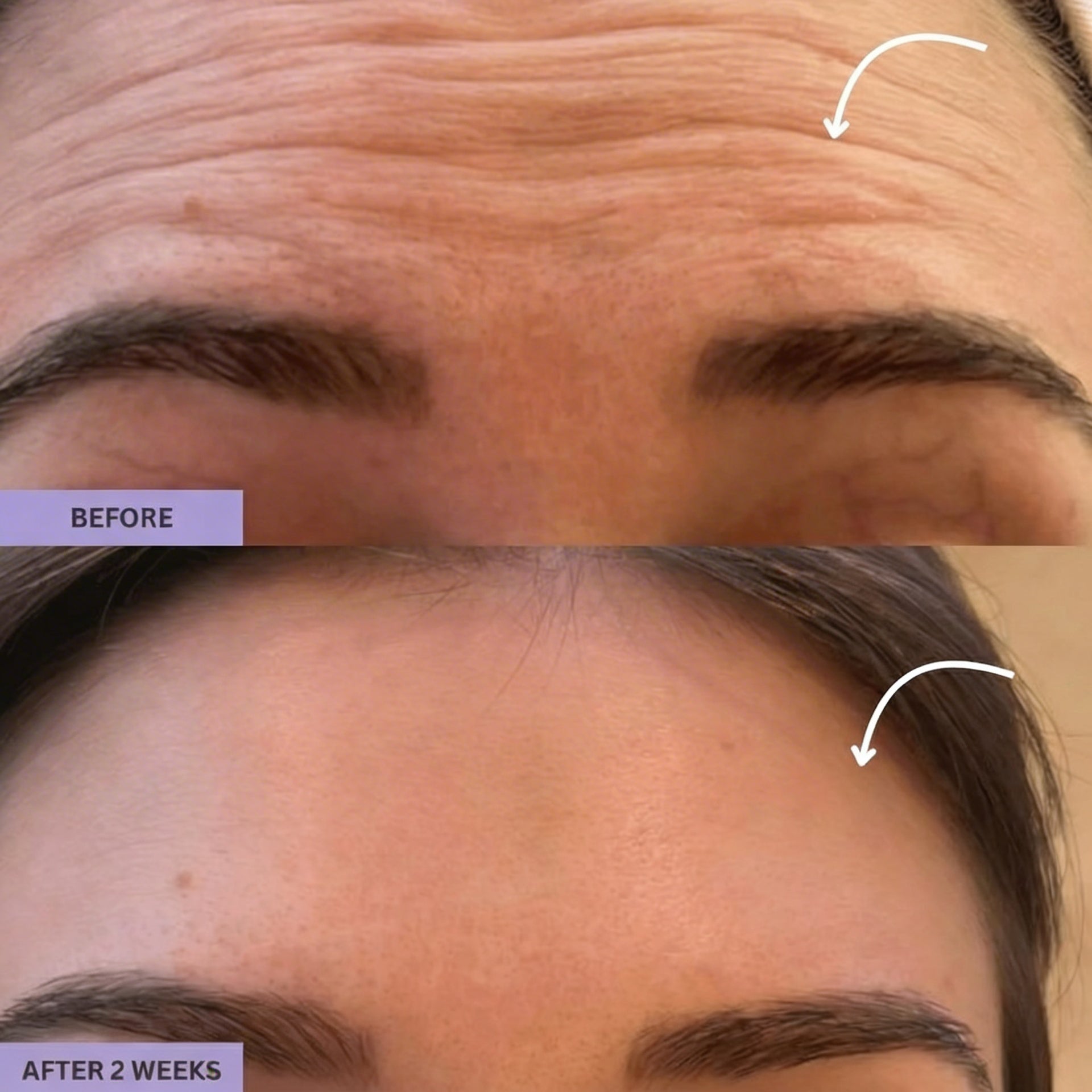 Gua Sha Brush for Snatched Face